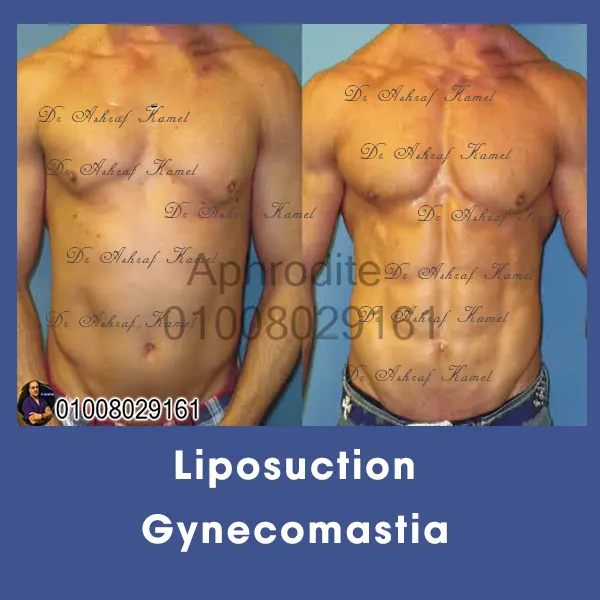 أرسم عضلاتك (ال 6 باكس)